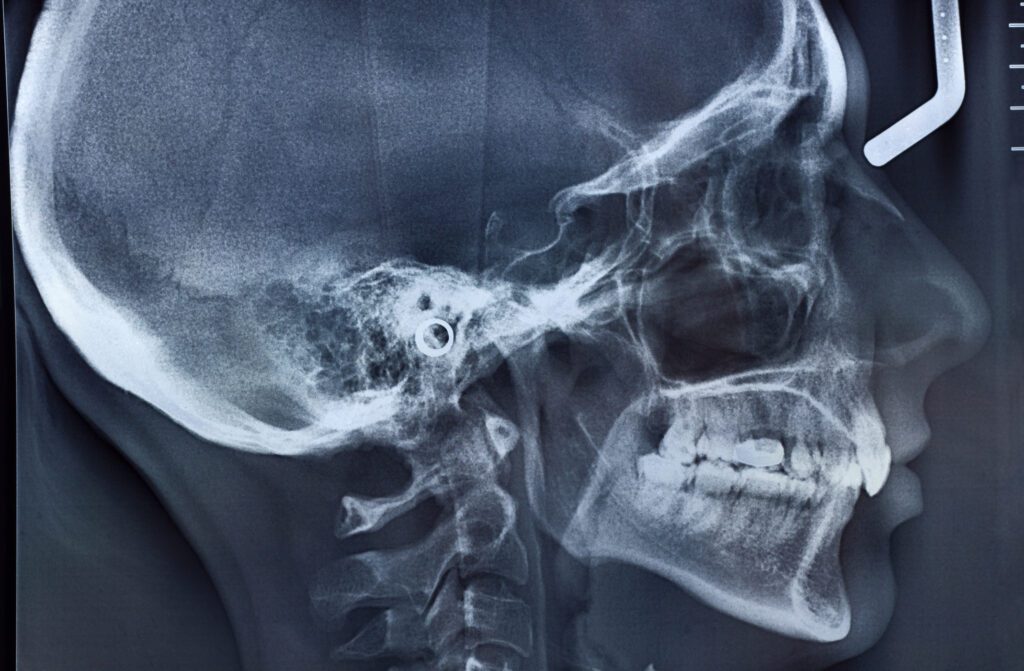 TMJ Therapy Arlington Heights IL