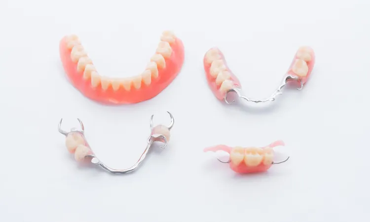Restoration Options for Tooth Loss in Chicago, IL